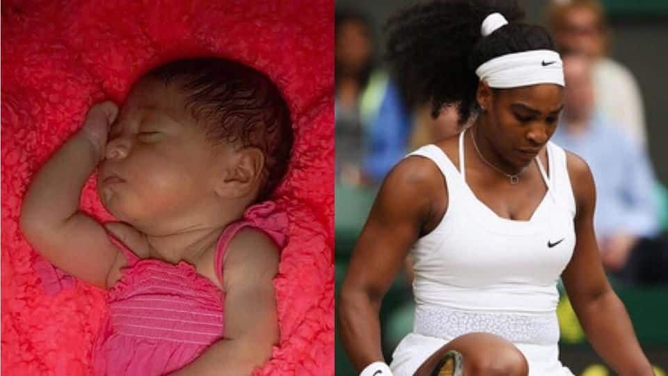 Defending champion, Serena Williams withdraws from Australian Open