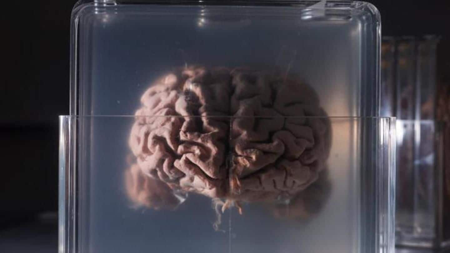Sign up to get your brain preserved after you die