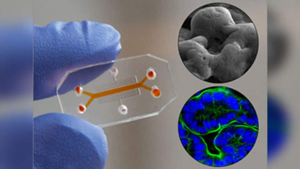 Scientists recreate human intestine environment inside organ-chip