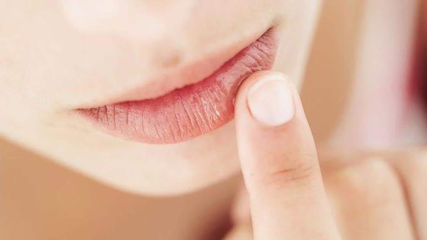Effective home remedies to get relief from chapped lips