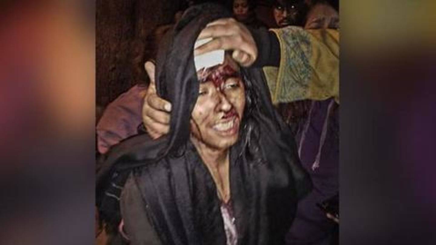 Can't talk: JNUSU President suffered grave injuries Can't talk: JNUSU President suffered grave injuries