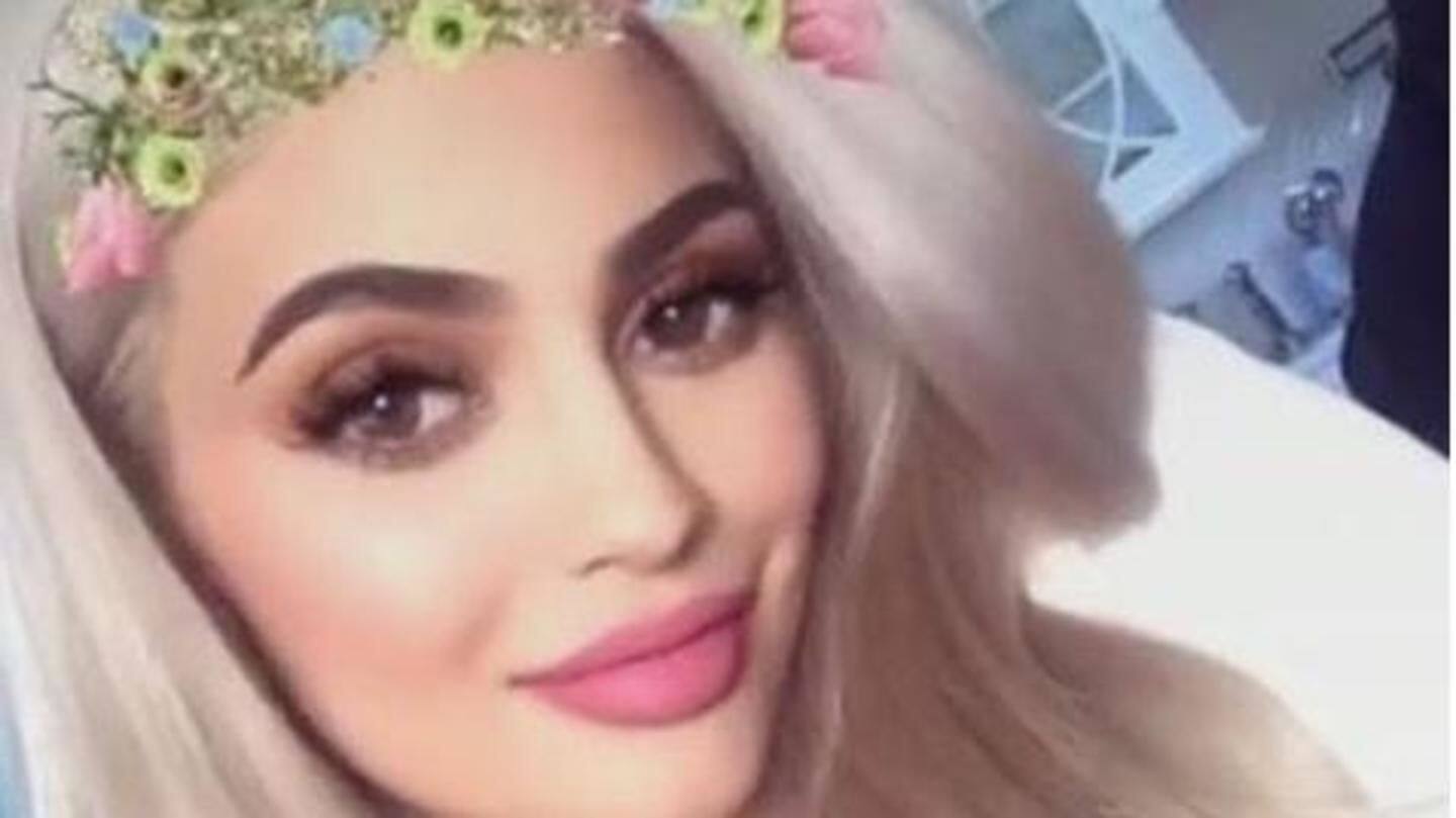 Snapchat dysmorphia: Aiming to mirror perfect-selfies, people want plastic surgeries