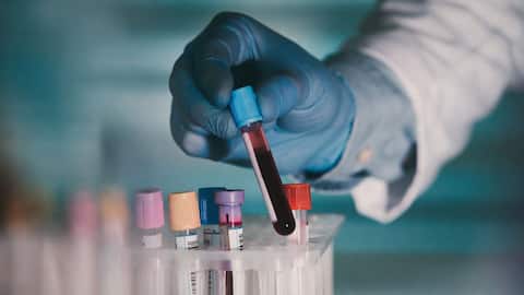 AI-generated drug reverses aging markers in human trials