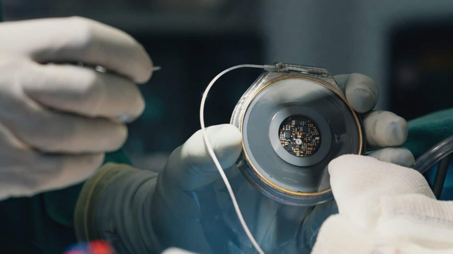Neuralink rival completes first human brain implant