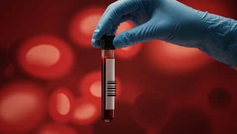 This blood test could detect up to 50 cancers early