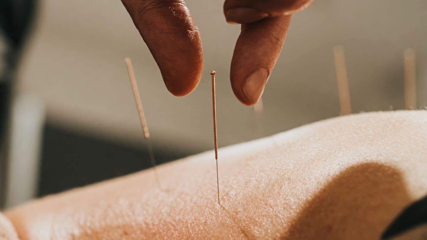 Beijing study finds acupuncture may rewire brain in depression
