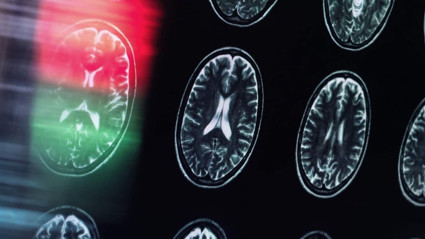 UCSF study finds nonopioid options for ER pain management