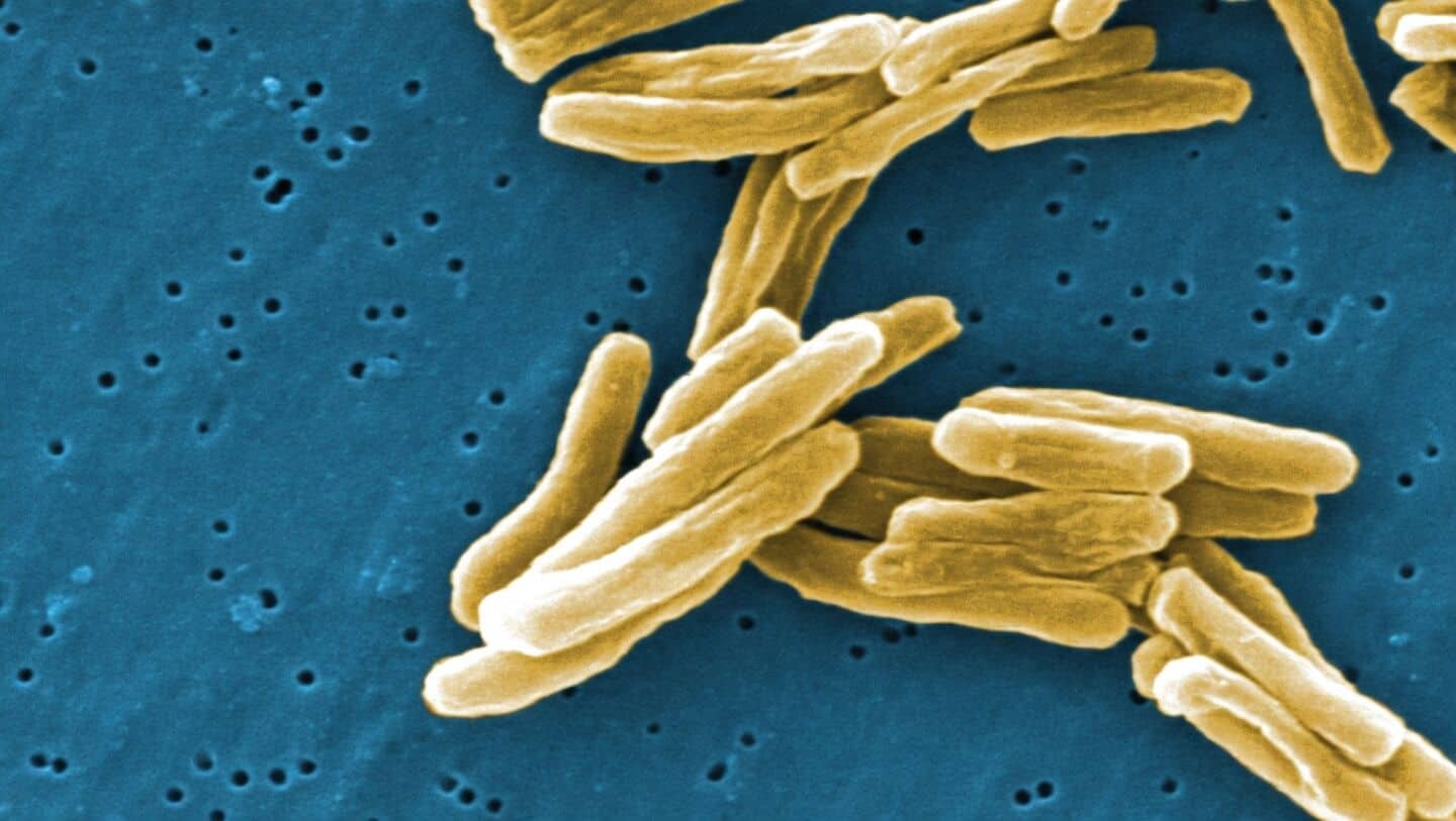 How TB bacteria outsmart antibiotics