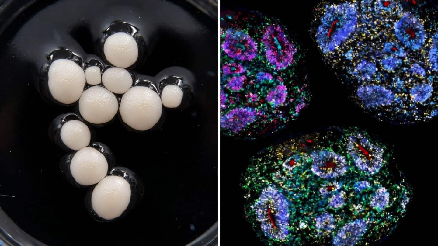 Harvard researchers grow mini human brain organoids nearly 7 years