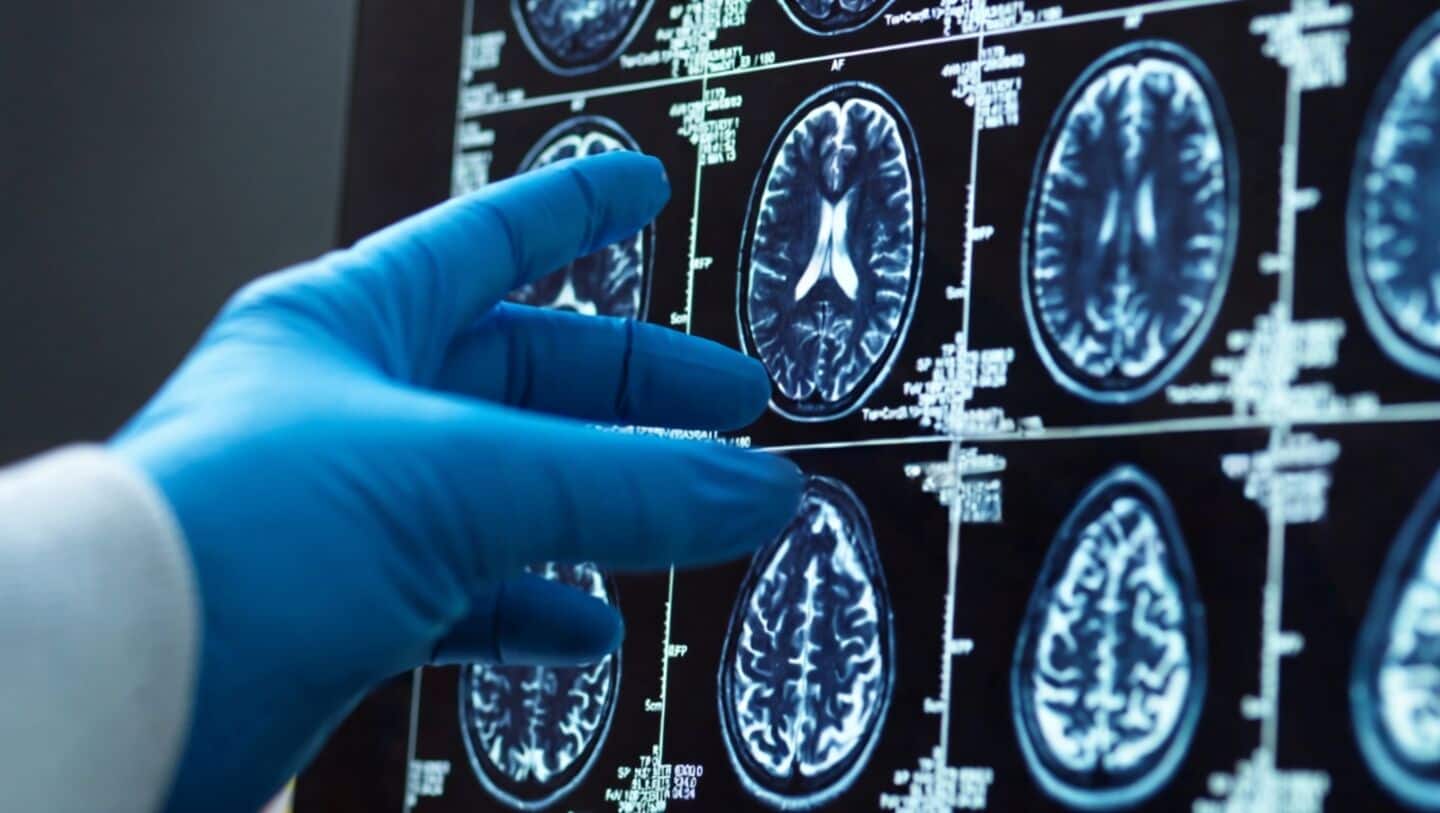 Manchester researchers pinpoint gene behind recessive RNU2-2-related disorder in children