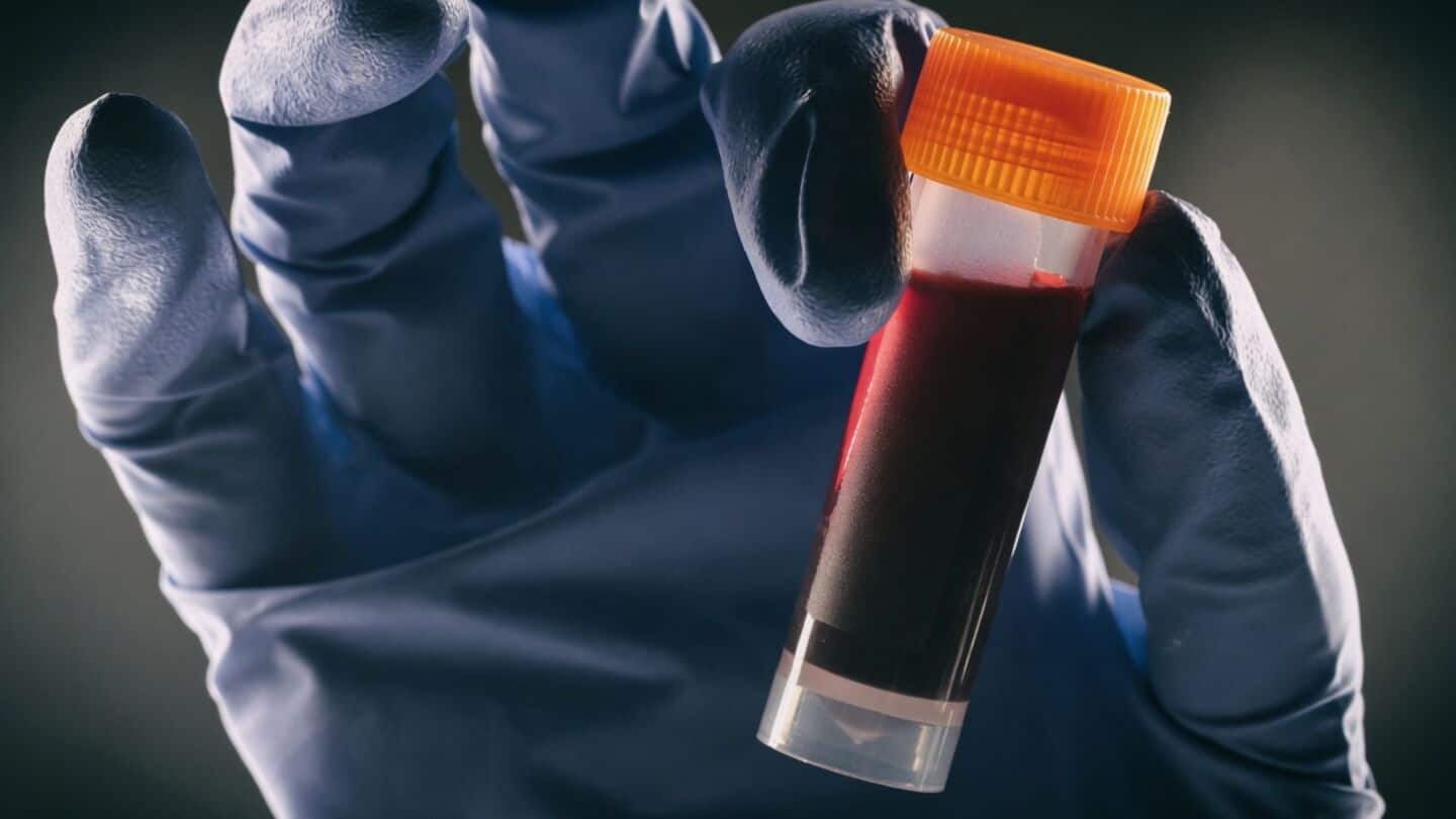 Study finds blood group B has 28% higher diabetes risk