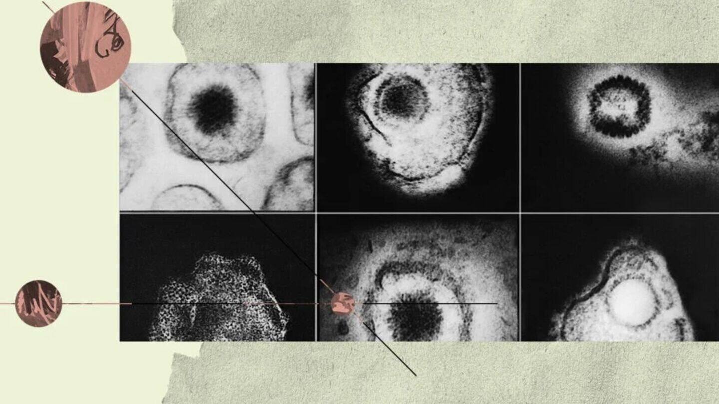 Harnessing herpes for groundbreaking cancer treatment