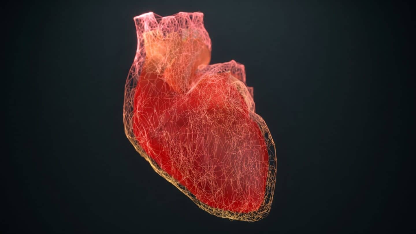Study ties 4 risks to nearly all heart attacks, strokes