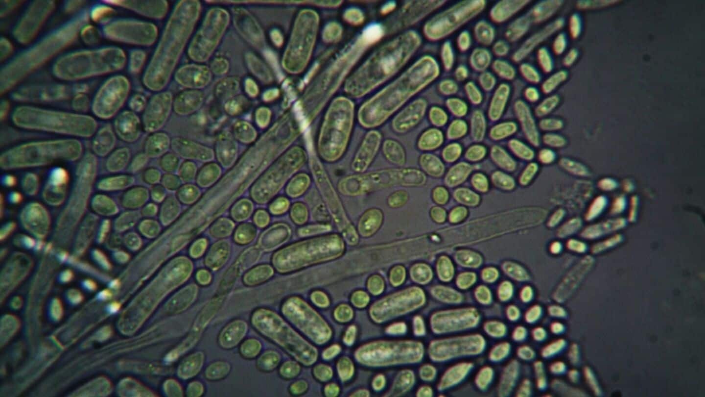 German scientists find bacteria that remove 95% of uranium