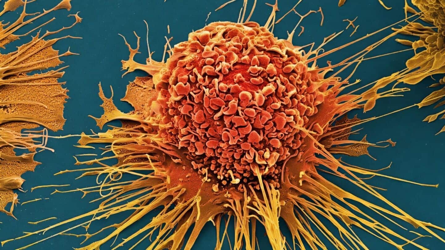 Texas scientists create 'molecular jackhammer' cancer treatment using near-infrared light