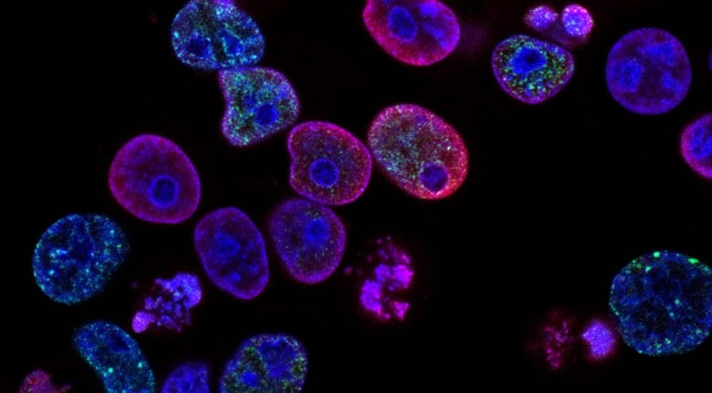 Revolution Medicines's daraxonrasib nearly doubles pancreatic cancer survival in trials