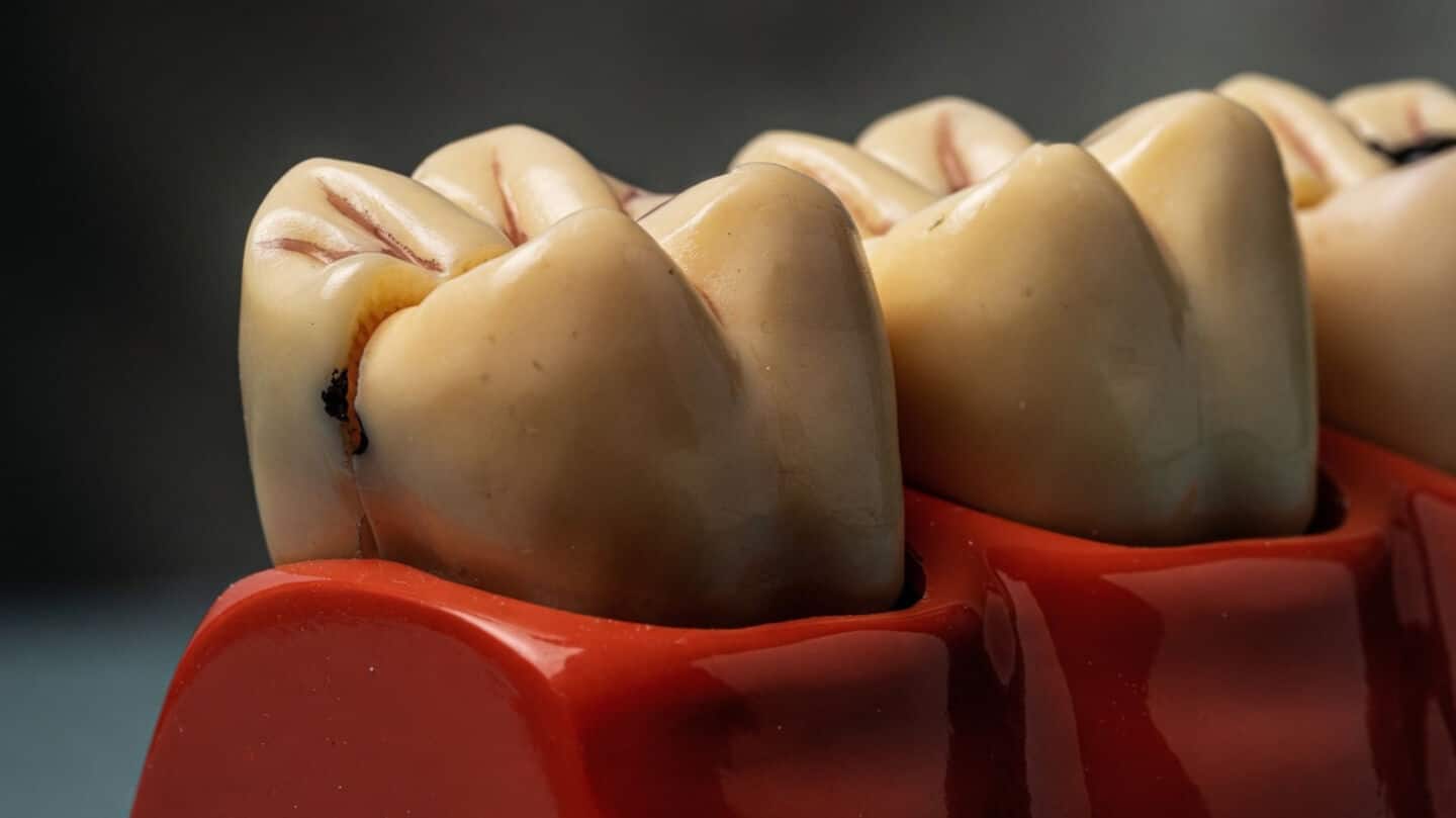 Toregem Biopharma moves to human trials of USAG-1-blocking tooth drug