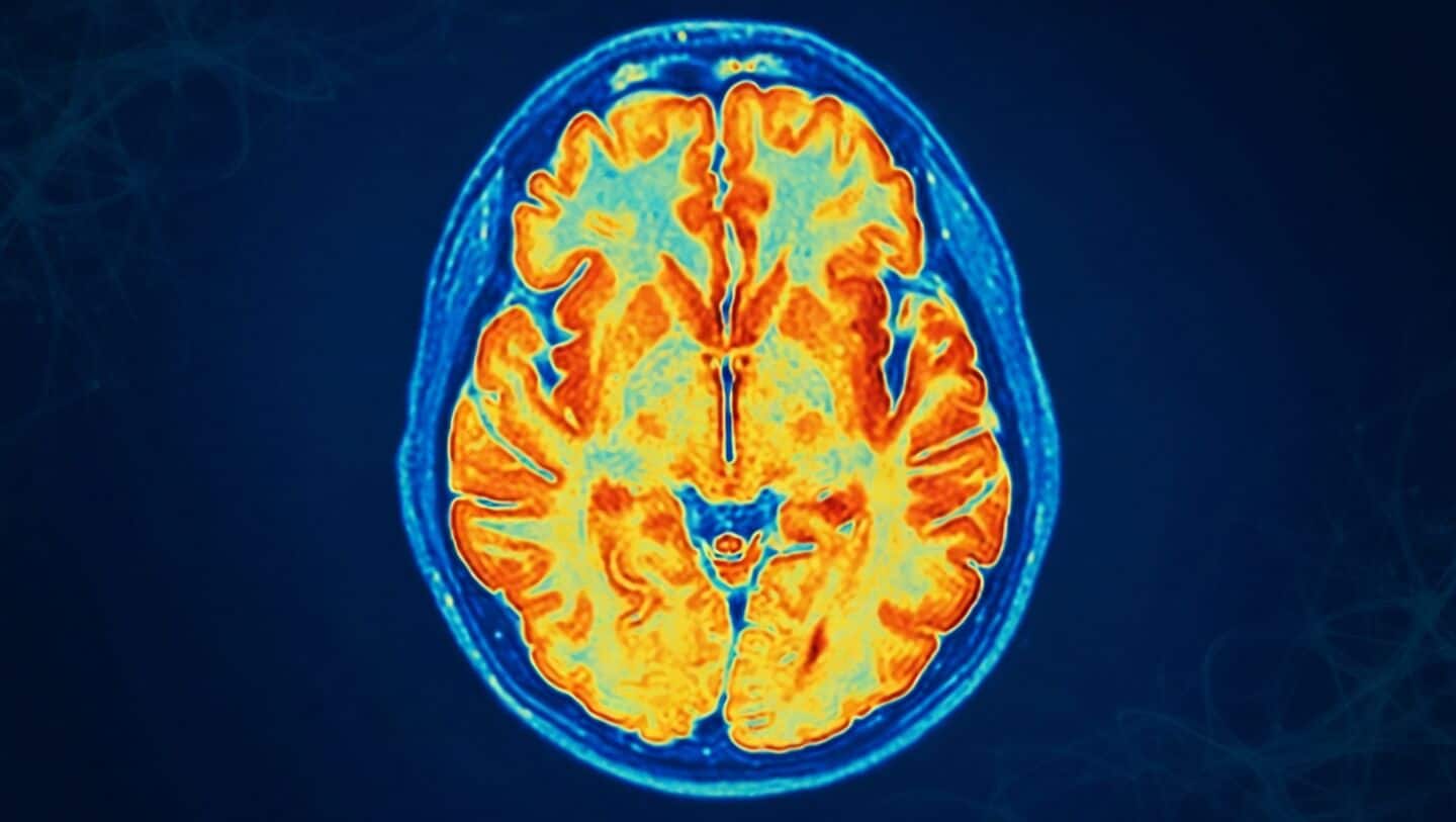 New ReNU2 syndrome linked to recessive RNU2-2 mutation explains delays