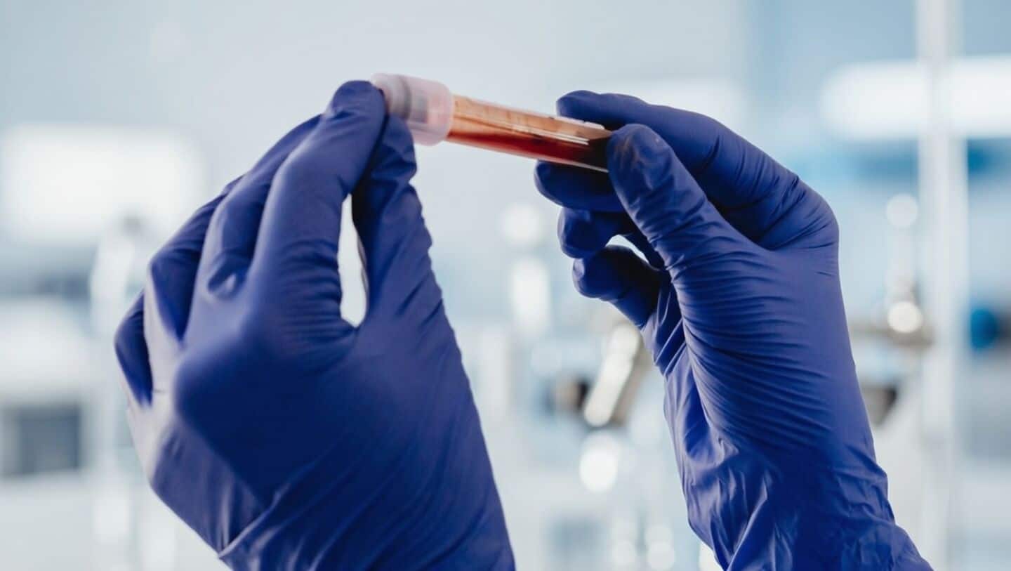 Women in space: Study finds microgravity alters their blood clotting