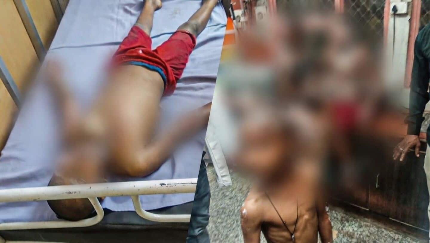 UP: Man pours boiling oil on kids playing at funeral