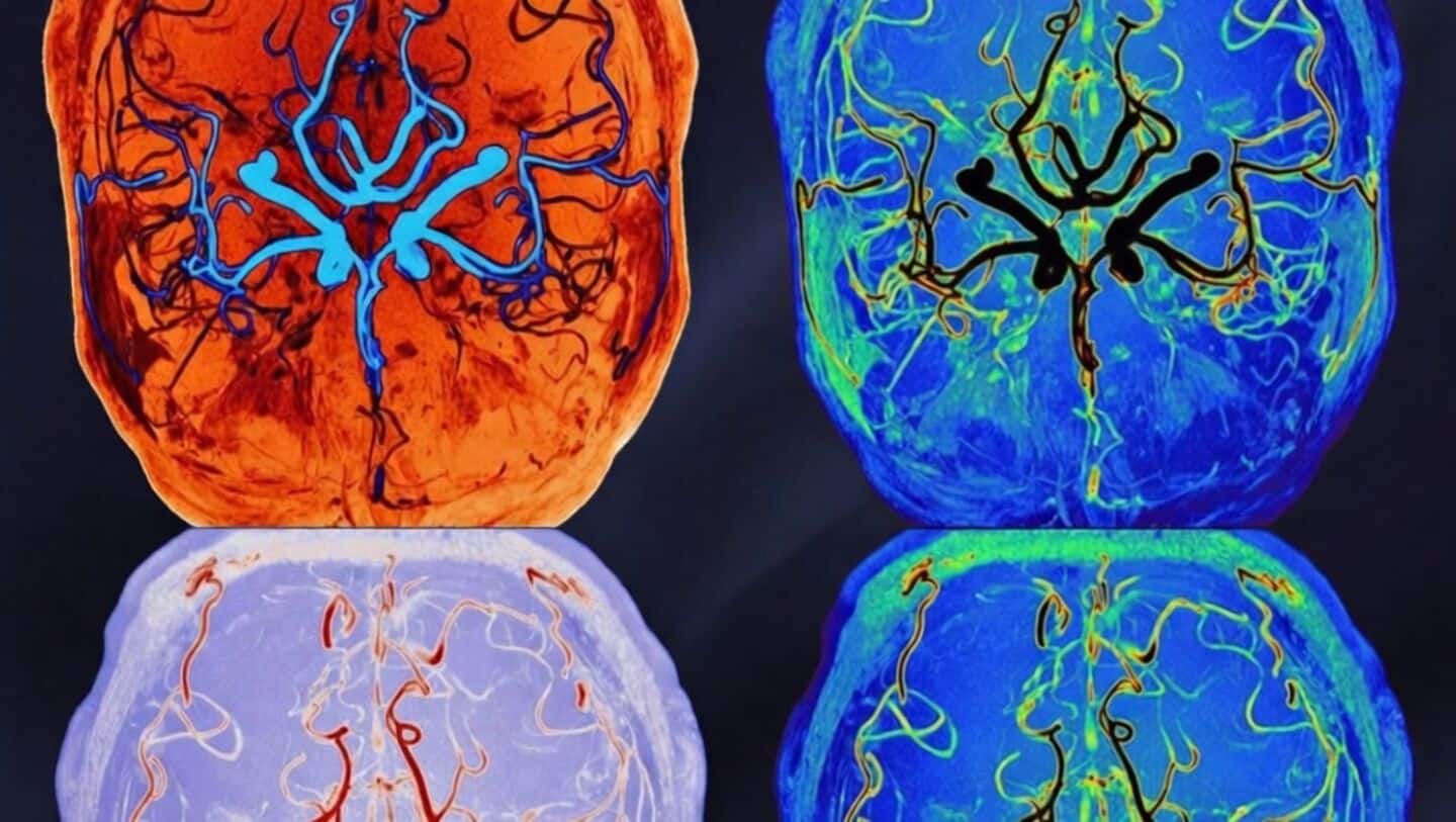 Finnish scientists find brain performs deep clean during sleep