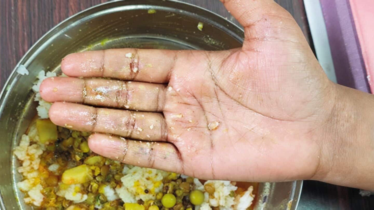 Glass found in midday meal at Pantnagar BMC-run school