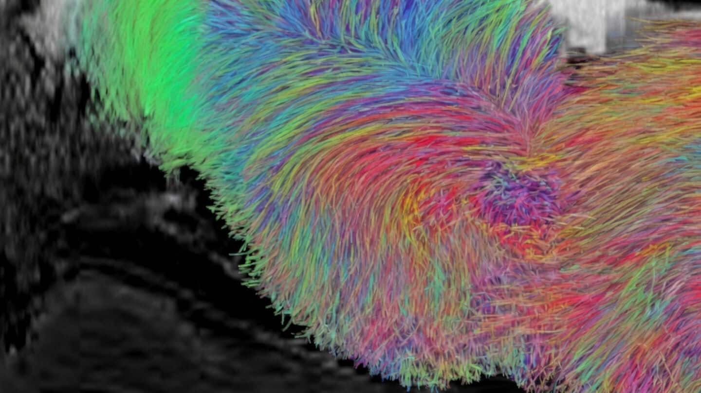 Stanford scientists grow human brain cells inside modified mice