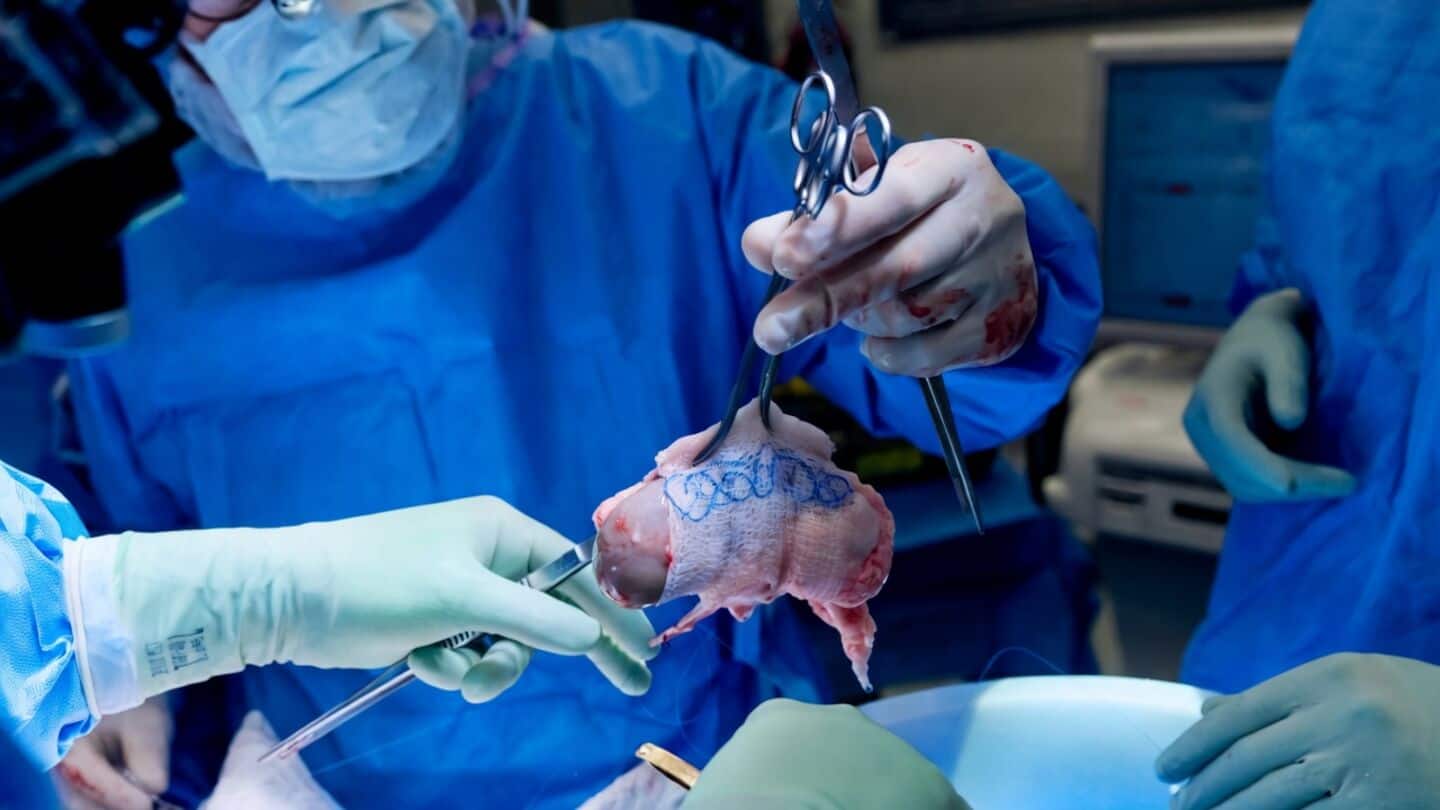 NYU Langone wins 2026 Gizmodo Science Fair for xenotransplantation work