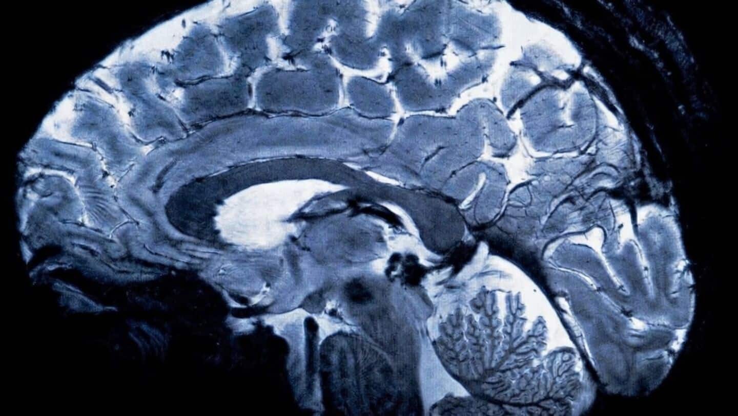 New treatment could help with schizophrenia's toughest symptoms