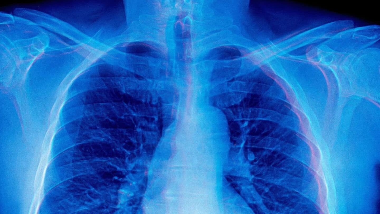 Stanford researchers identify 'mirage reasoning' in medical AI models