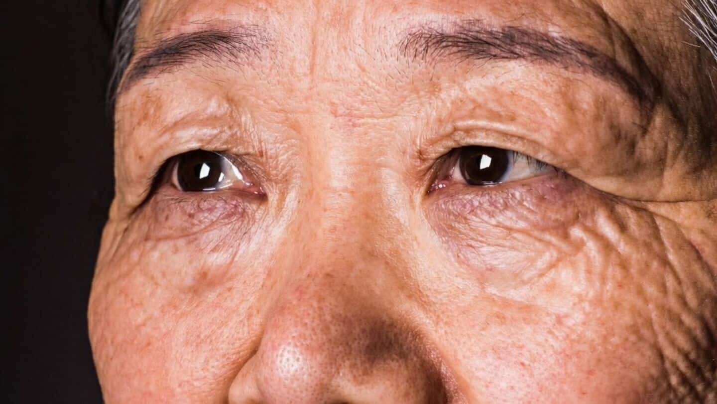 UK and Australian studies link eyesight to dementia risk