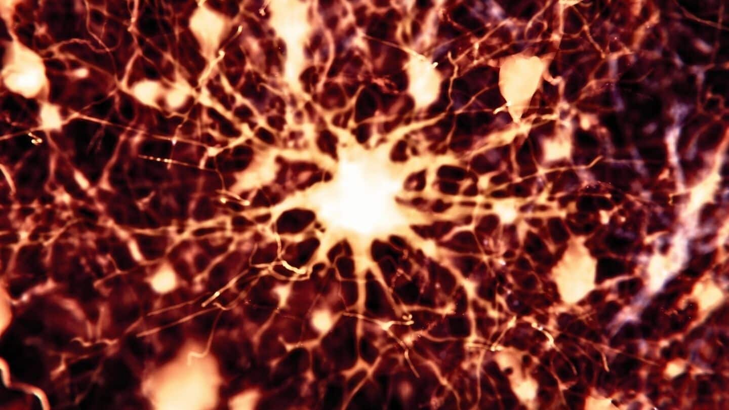 Letrozole and irinotecan reverse Alzheimer's disease brain damage in mice