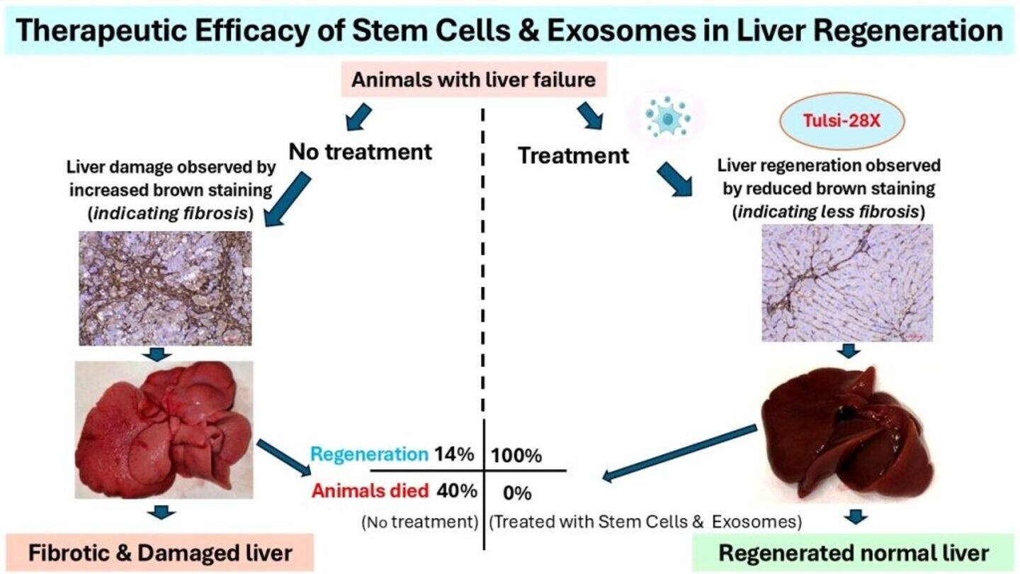 Hyderabad startup's stem cell therapy could treat chronic liver failure