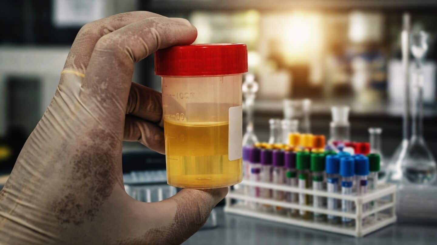 Study finds GALEAS bladder 92.2% sensitive, may guide cystoscopy decisions