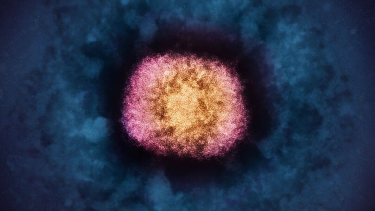 Scientists find human BC200 derived sequences in molluscum contagiosum virus