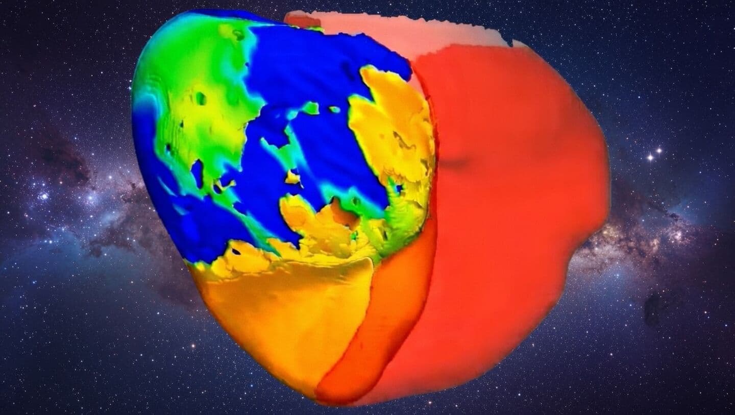 Johns Hopkins creates digital twin heart for ventricular tachycardia treatment
