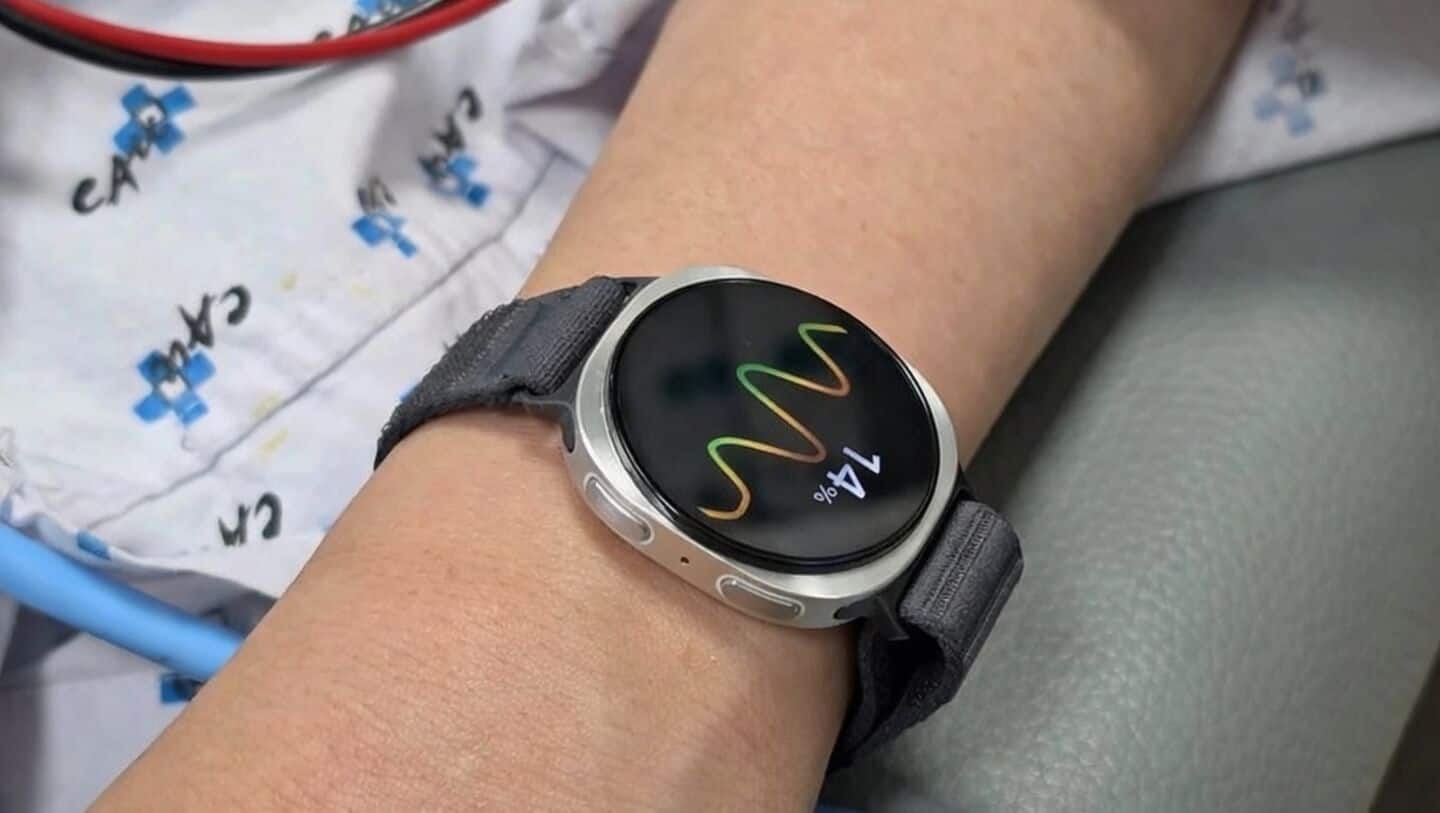 Samsung's Galaxy Watch may warn of fainting 5 minutes early