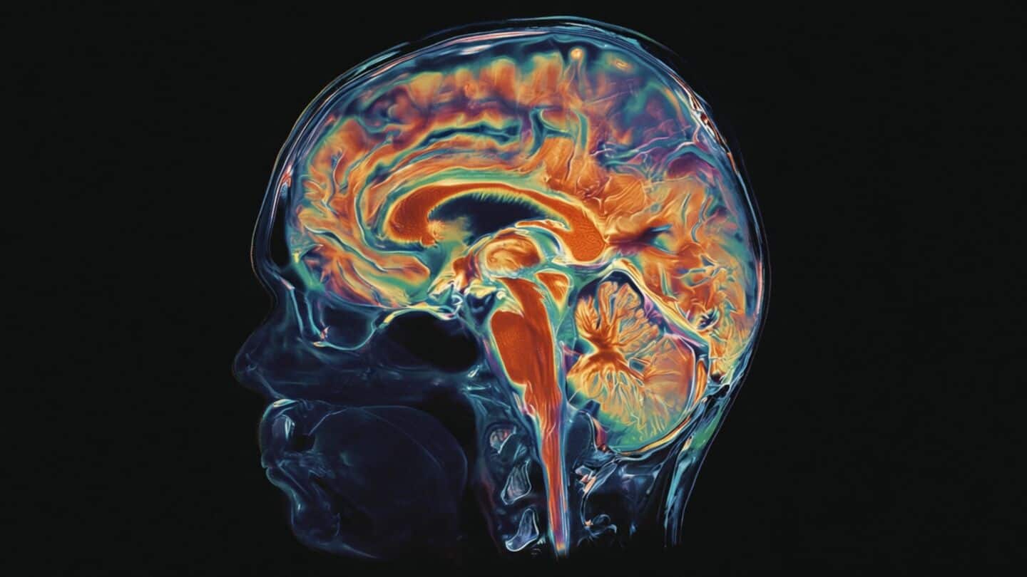 Perelman study finds amyloid clearance may slow Alzheimer's progression