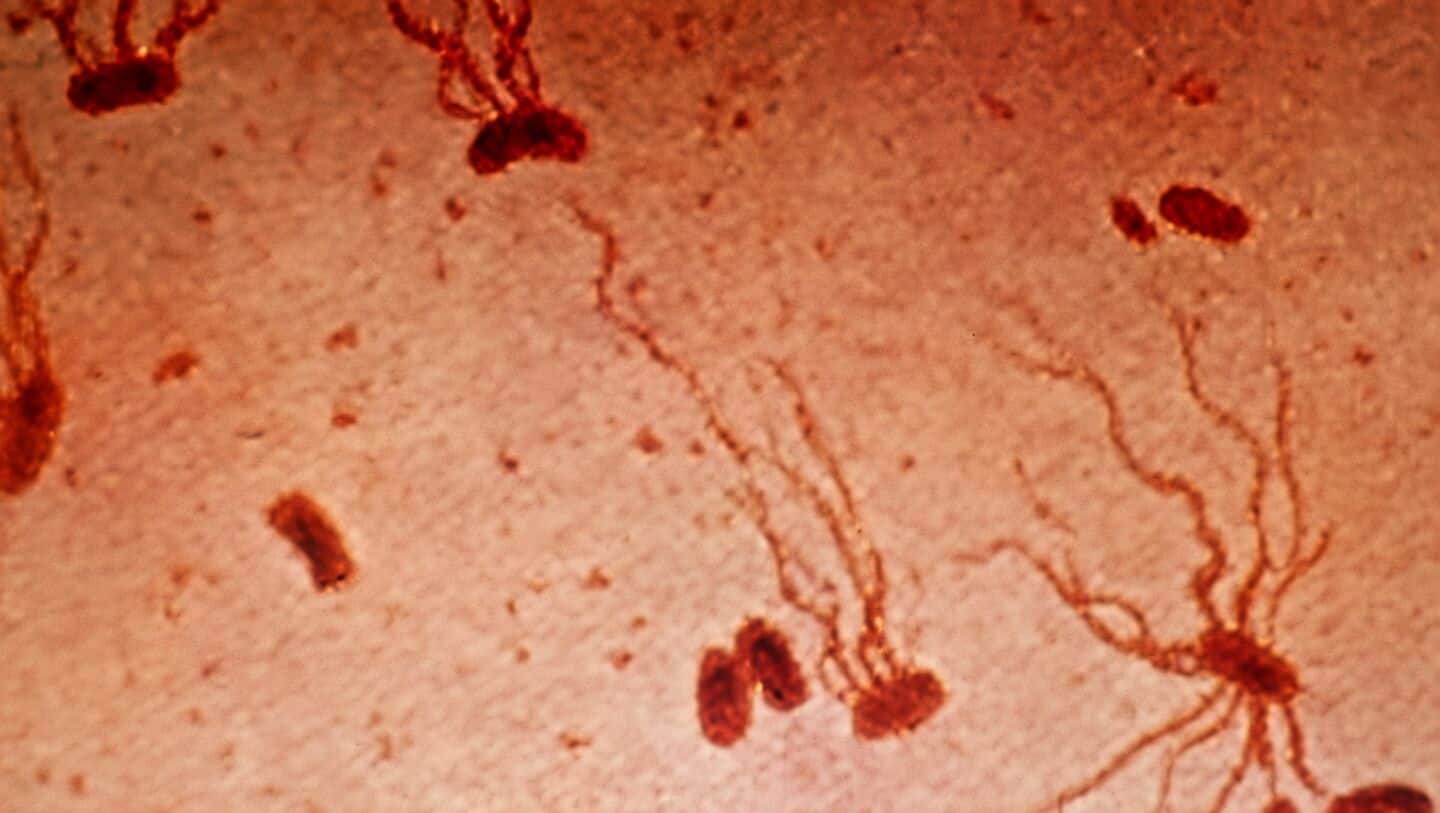 Study finds antibiotic-resistant XDR Typhi spreading from South Asia globally