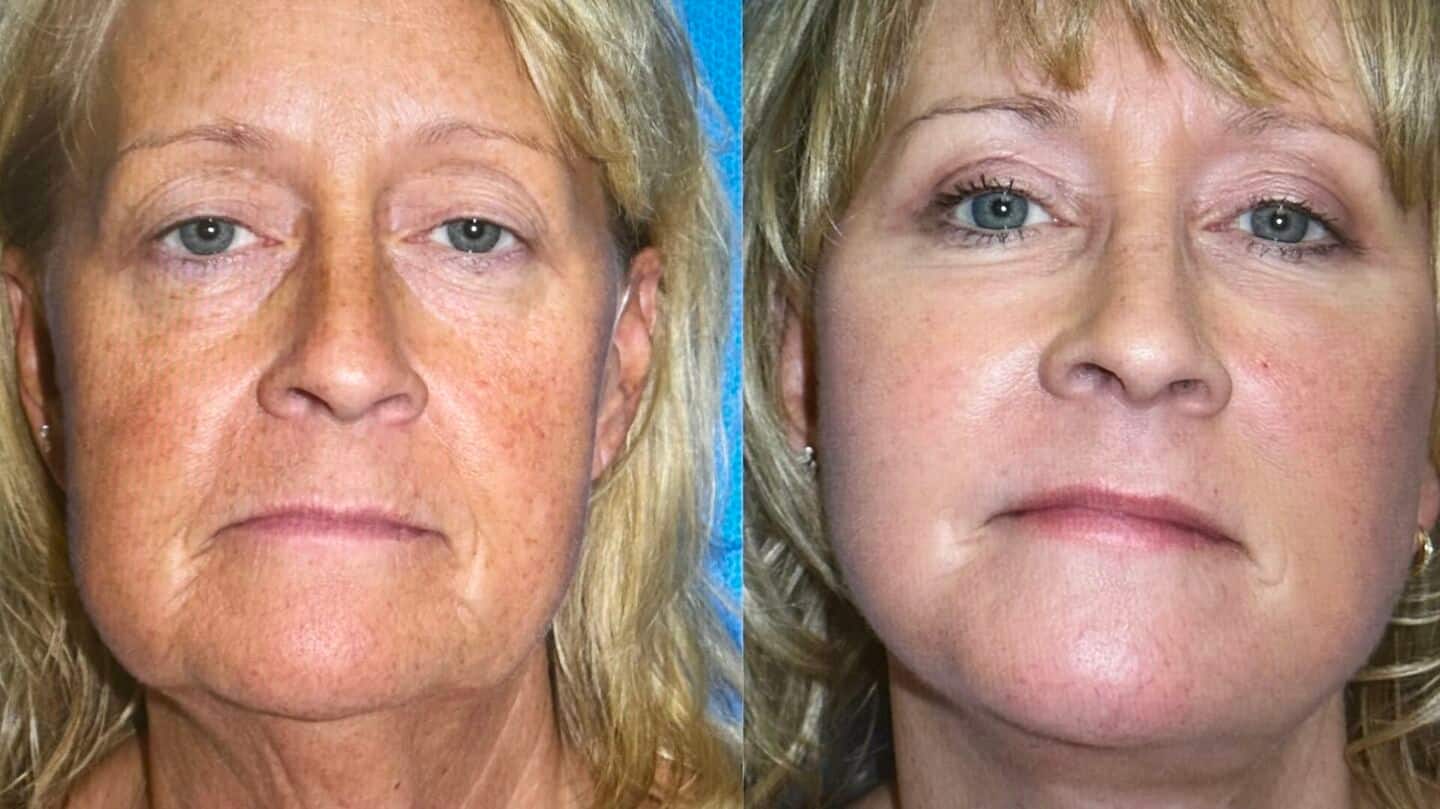 Stem cells can delay aging, says new study