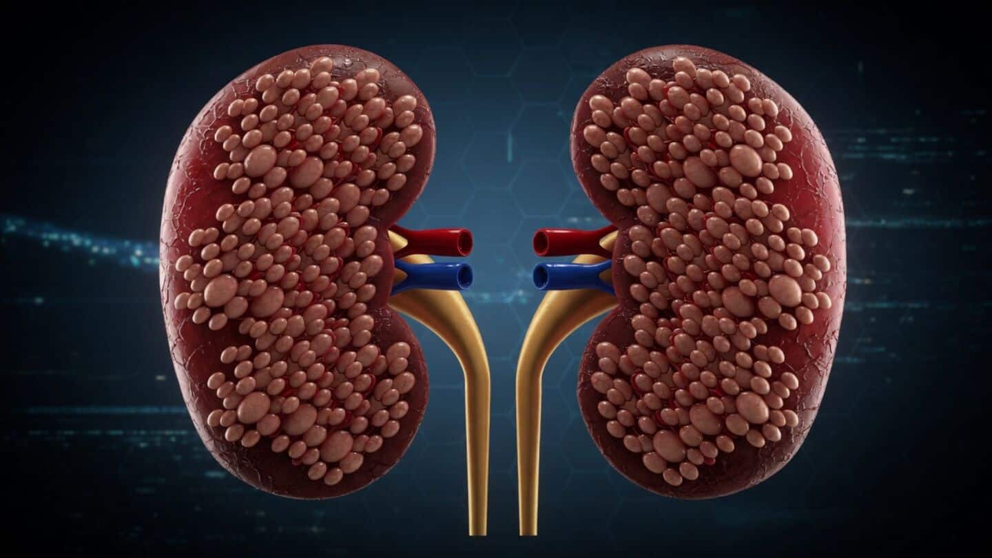 About half of 844 million global CKD cases remain undiagnosed