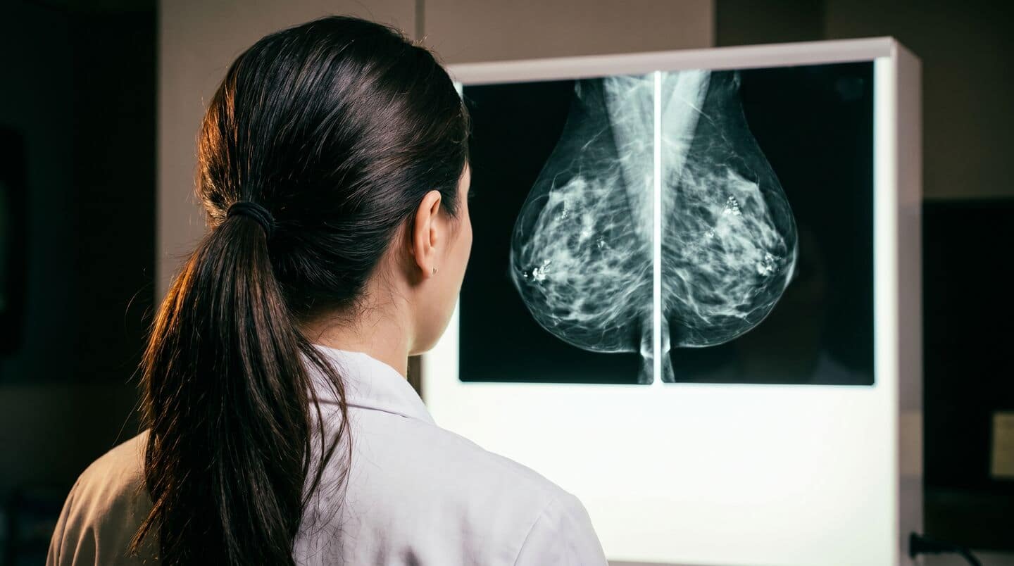 Cambridge and BC researchers find postmenopausal tissue aids cancer survival