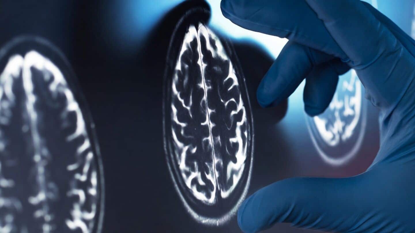 Scientists show CD8+ T cells outside brain drive Alzheimer's neurodegeneration