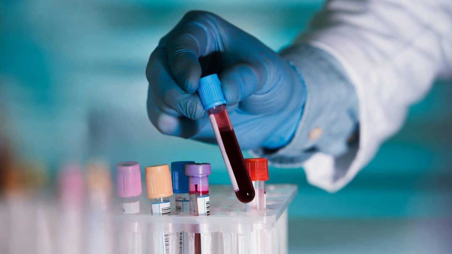 Nature Biotechnology study finds AI-created drug rentosertib lowers aging markers