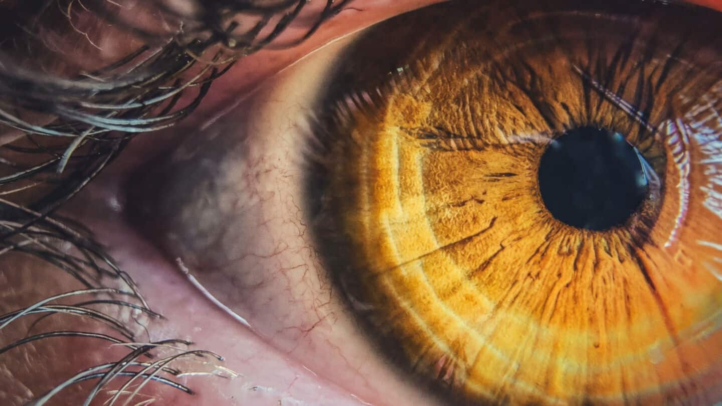 Northwestern University study finds 30% retinal disease rise after DST