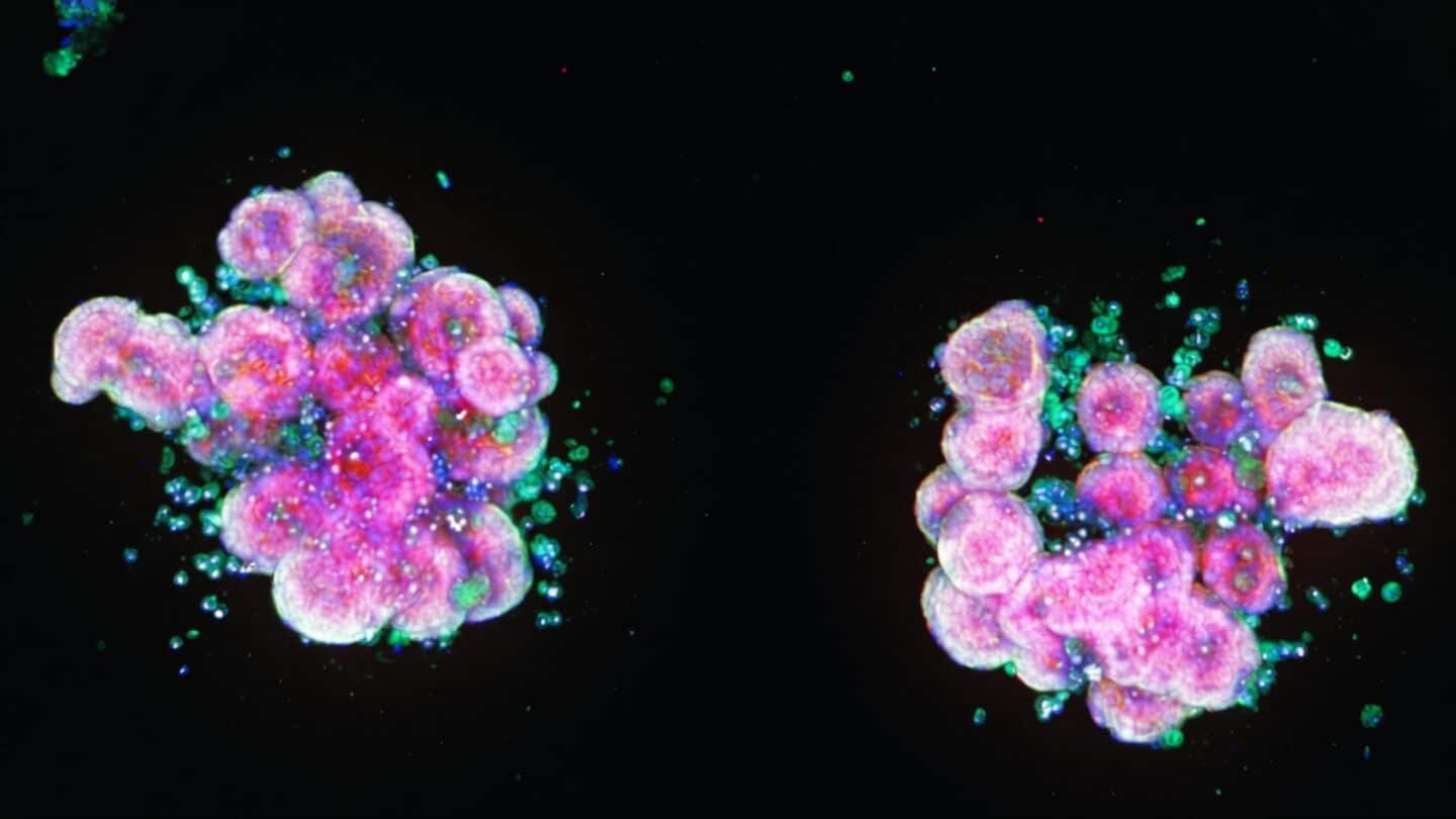 Cambridge to open £20m AI hub using human tissue models