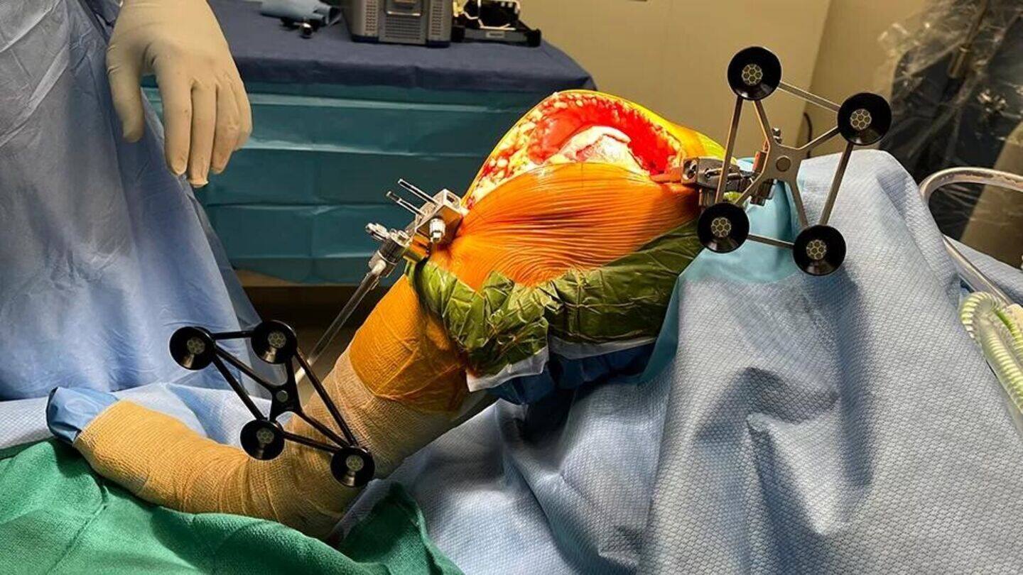 Vidya Sagar Hospital performs 500 robotic knee replacement surgeries