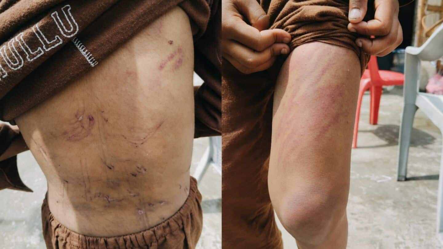 Kishtwar boy aged 9 flees madrasa after alleged teacher beating
