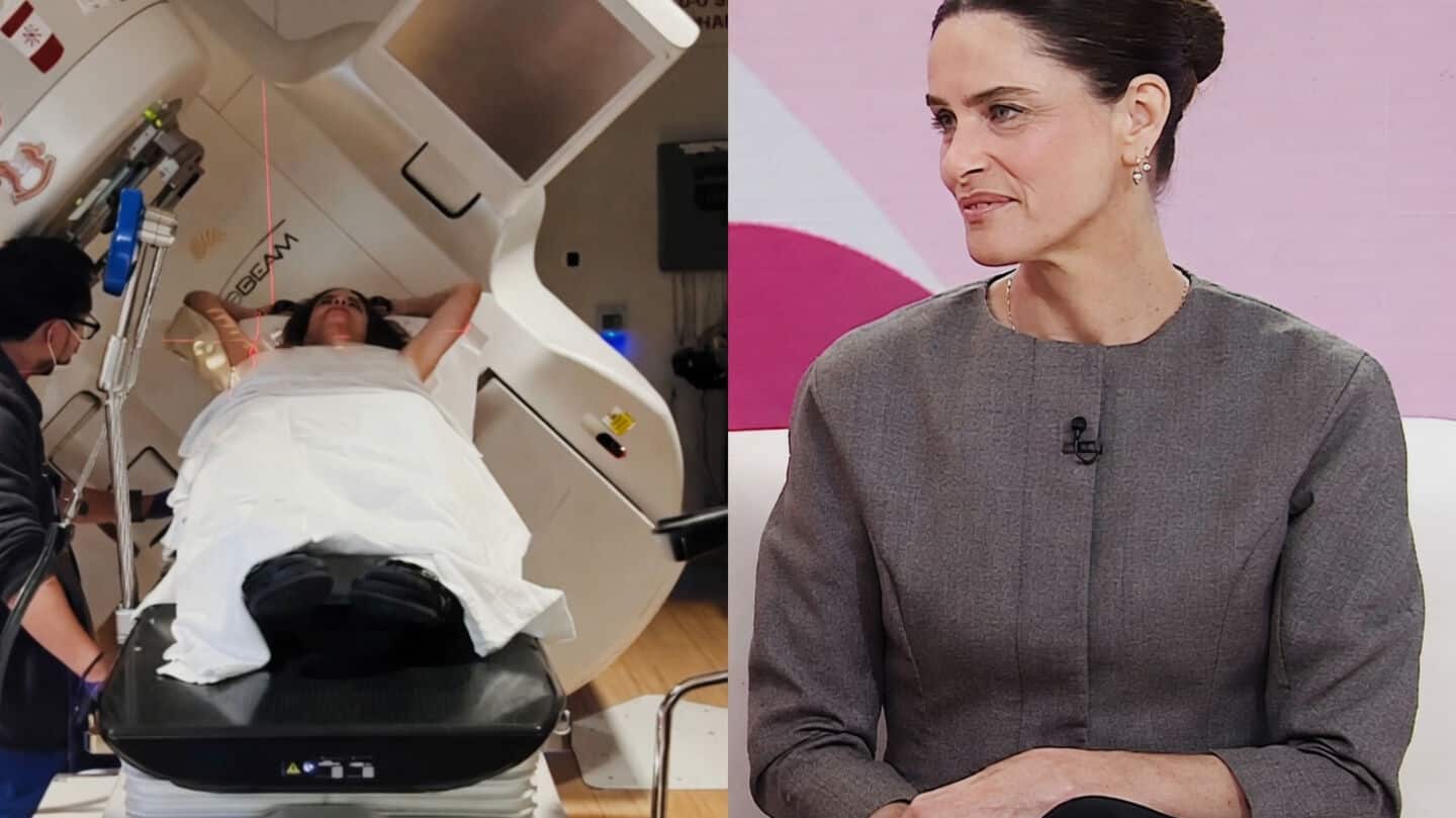 Peet details noticing skin changes before lobular breast cancer diagnosis