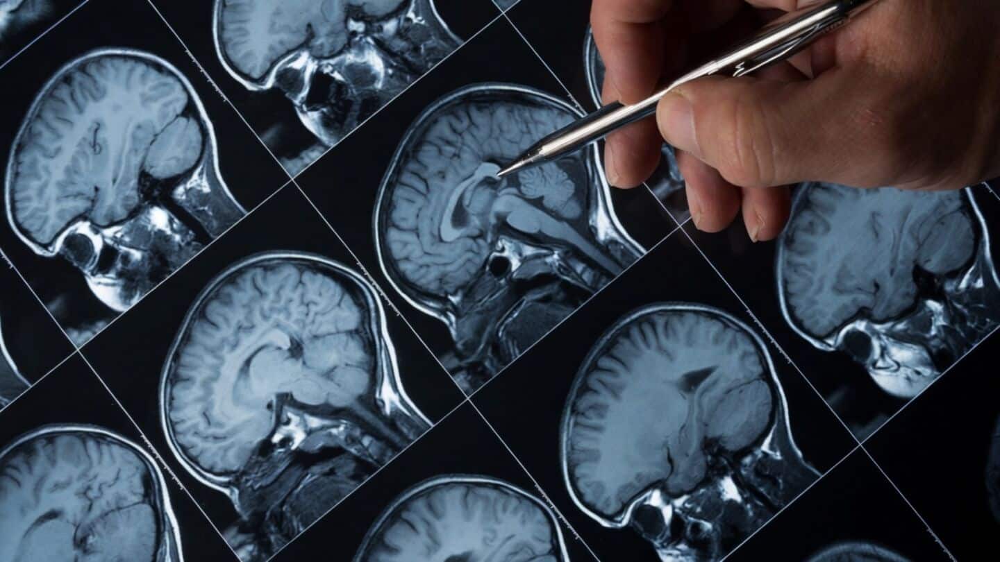Kerala autorickshaw driver from Naderi dies of amoebic meningoencephalitis